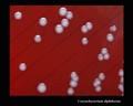 corynebacterium diphtheriae